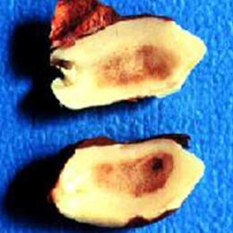 Visual representation of Boron Deficiency deficiency